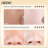 OEDO Gold Blackhead Mask Improves Facial Moisturizes & Rejuvenates Skin