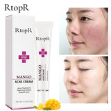 RtopR Mango Acne Treatment Moisturizing Cream