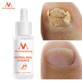 MeiYanQiong Nail Treatment Serum - Hand and Foot Care