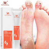 MeiYanQiong Foot Care Cream